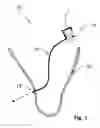 Fig. 02 - Method of mounting a hearing device component inside a hearing device