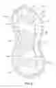 Fig. 22 - PET TOY