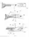 Fig. 02 - Electro-mechanical skin pulling, altering and lifting device with optional remote control