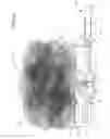 Fig. 06 - BATH SPONGE WITH SOAP CONTAINER AND RETRACTABLE HANDLE