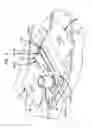Fig. 06 - Implement head cleaning system