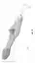 Fig. 28 - Method and apparatus for manipulating the side wall of a body lumen or body cavity so as to provide increased visualization of the same and/or increased access to the same, and/or for stabilizing instruments relative to the same