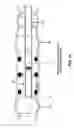 Fig. 75 - Method and apparatus for manipulating the side wall of a body lumen or body cavity so as to provide increased visualization of the same and/or increased access to the same, and/or for stabilizing instruments relative to the same