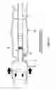 Fig. 76 - Method and apparatus for manipulating the side wall of a body lumen or body cavity so as to provide increased visualization of the same and/or increased access to the same, and/or for stabilizing instruments relative to the same