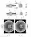 Fig. 77 - Method and apparatus for manipulating the side wall of a body lumen or body cavity so as to provide increased visualization of the same and/or increased access to the same, and/or for stabilizing instruments relative to the same