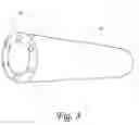 Fig. 08 - Optical endoluminal far-field microscopic imaging catheter