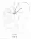 Fig. 07 - Systems for and methods of diagnosing and treating a sacroiliac joint disorder