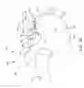 Fig. 09 - Systems for and methods of diagnosing and treating a sacroiliac joint disorder