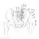 Fig. 22 - Systems for and methods of diagnosing and treating a sacroiliac joint disorder