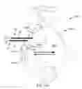 Fig. 32 - Systems for and methods of diagnosing and treating a sacroiliac joint disorder