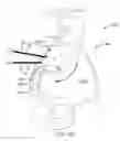 Fig. 35 - Systems for and methods of diagnosing and treating a sacroiliac joint disorder