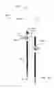 Fig. 40 - Systems for and methods of diagnosing and treating a sacroiliac joint disorder