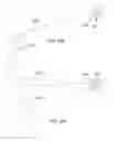 Fig. 49 - Systems for and methods of diagnosing and treating a sacroiliac joint disorder