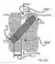 Fig. 65 - Systems for and methods of diagnosing and treating a sacroiliac joint disorder