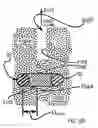 Fig. 67 - Systems for and methods of diagnosing and treating a sacroiliac joint disorder