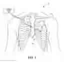 Fig. 02 - Automatic heart rate diagnostics