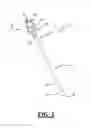 Fig. 03 - Insulated pedicle access system and related methods