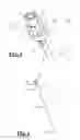 Fig. 04 - Insulated pedicle access system and related methods