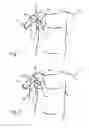 Fig. 02 - LIGHT BASED LOCATION AND IDENTIFICATION OF IMPLANTED MEDICAL DEVICES