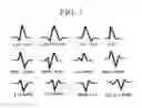 Fig. 06 - METHOD FOR BIOMETRIC HUMAN IDENTIFICATION BASED ON ELECTROCARDIOGRAM AND PTT SMART WATCH SYSTEM USING THE SAME METHOD