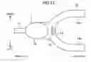 Fig. 08 - Probe for measuring lip closing force