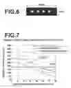 Fig. 04 - Ultrasound probe