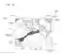 Fig. 167 - Methods and devices to decrease tissue trauma during surgery