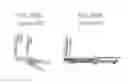 Fig. 82 - Methods and devices to decrease tissue trauma during surgery
