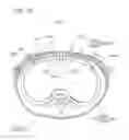 Fig. 99 - Methods and devices to decrease tissue trauma during surgery