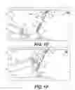 Fig. 04 - Systems, devices, and related methods for retracting tissue