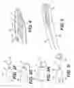 Fig. 08 - Systems, devices, and related methods for retracting tissue