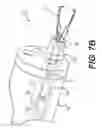 Fig. 11 - Systems, devices, and related methods for retracting tissue
