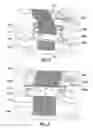 Fig. 07 - Device for management of an open abdomen