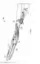 Fig. 02 - Robotic Assisted clip applier