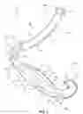 Fig. 02 - Surgical ligation clip