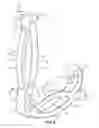 Fig. 09 - Surgical ligation clip