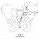 Fig. 02 - Systems for and methods of preparing a sacroiliac joint for fusion