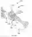 Fig. 85 - Systems for and methods of preparing a sacroiliac joint for fusion