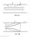 Fig. 03 - Flow restoration systems and methods for use