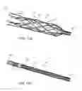 Fig. 09 - Flow restoration systems and methods for use