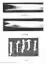 Fig. 06 - Method and apparatus for tissue grafting