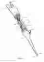Fig. 03 - Ultrasonic surgical device with reduction in electrical interference