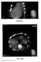 Fig. 05 - SYSTEMS AND METHODS FOR ELECTRODE PLACEMENT IN DEEP MUSCLES AND NERVES USING ULTRASOUND GUIDANCE