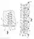 Fig. 06 - Flexible maxillo-mandibular fixation device