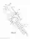 Fig. 07 - UNIPLANAR BONE ANCHOR SYSTEM
