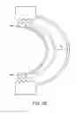 Fig. 09 - Dynamized interspinal implant