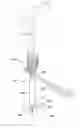 Fig. 01 - Apparatus and methods for reduction of vertebral bodies in a spine