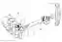 Fig. 01 - Tightening device for spine surgery