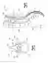 Fig. 02 - Tightening device for spine surgery