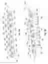 Fig. 09 - Flexible plate fixation of bone fractures